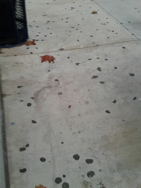 Gum Removal - Before